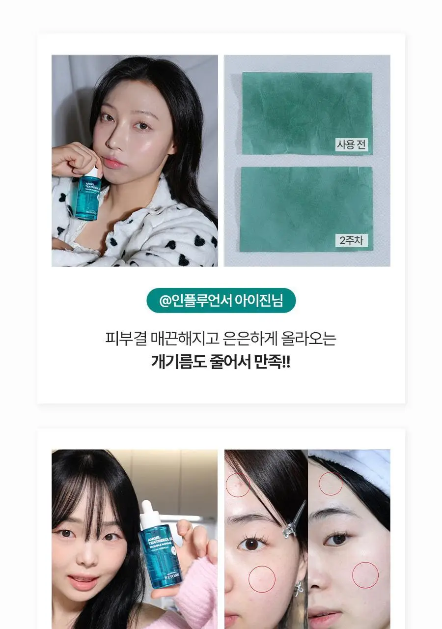 [피지&모공 7일케어] 비욘드 엔젤 티트리올 10% 트러블 앰플 50ml 상세페이지 8